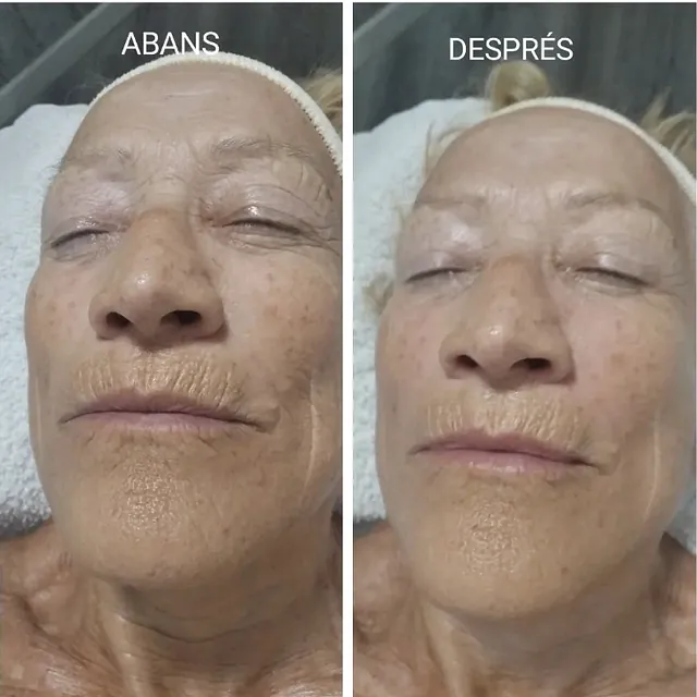 Essència Manlleu tratamiento facial